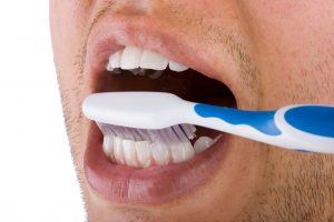 chollo limpieza bucal 4